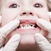 علاج اسنان مجاني • جامعة الفراهيدي • تنظيف وحشوات