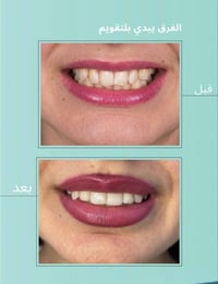 من أول زيارة إلى آخر موعد… كانت النتيجة ابتسامة تستحق كل خطوة ونشارككم...