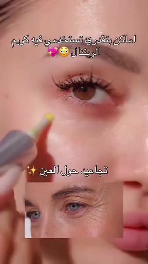 جديد 💅 كازز بيوتي 🥰 ب15الف 💸 

كريم Celimax ريتينال  الكوري الكريم الأقوى لشد البشرة

 💛✨بشرتك تستحق القوه والشباب!💛✨
✅ معلومات عن هذا المنتج :
يحتوي على الريتينال لإزالة التجاعيد بفعالية
يحسن مرونة البشرة ويمنحها مظهراً مشدوداً وشاباً
يساعد على التخلص من خشونة المسام ويوحد ملمس البشرة

 مزود بتقنية A Shot:
#يعني يوصل  إلى أعمق طبقات البشرة🥹 لتغذيتها بفعالية وتحسين النضارة والإشراقة من الداخل.

#الحجم: 150 مل

طريقة الاستخدام:👇
يُستخدم ليلاً، مرة واحدة أسبوعياً فقط
⚠️ تنبيه: غير مناسب للحوامل والمرضعات


**إذا كنت صاحب هذا الإعلان وتريد حذفه لأي سبب، رجاءا أرسل رسالة إلى الدعم الفني**