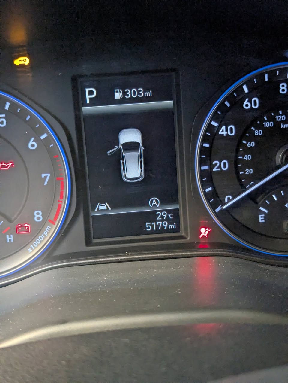 السلام عليكم
للبيع hyundai kona
موديل 2023
وارد امريكي
حادثهة موضح بلصور 
ماشية 5179mi - 8336km 
محرك 2000 دوش 
كير AT
رقم بغداد جديد
سعر 145$
للاستفسار ***********
