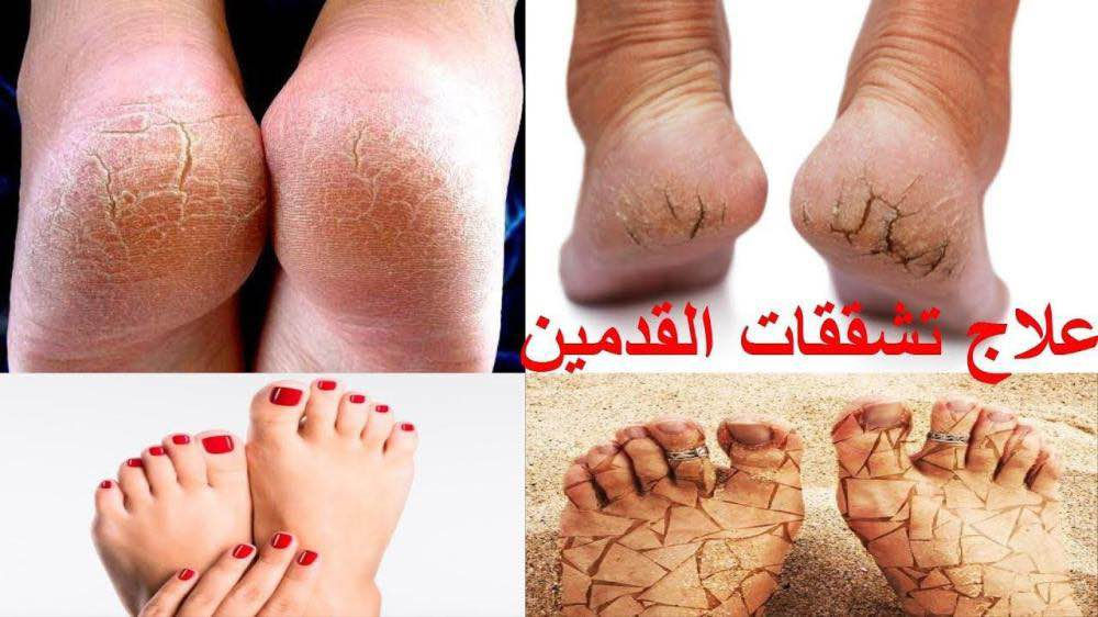 10الاف ناصرية, ذي قار


**إذا كنت صاحب هذا الإعلان وتريد حذفه لأي سبب، رجاءا أرسل رسالة إلى الدعم الفني**