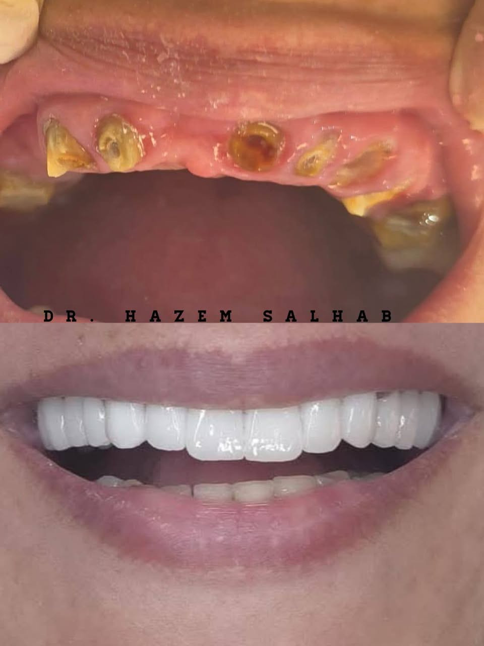 نقدم لكم أفضل خدمات طب وتجميل الأسنان
بأحدث الأجهزة وعلى أيدي أطباء متخصصين 👨‍⚕️👩‍⚕️

📍 متواجدون يوميًا
للاستشارات والعلاج بكل عناية واهتمام

📞
عيادة الرحمة – لأن ابتسامتك تهمنا 🤍

*********** 
خصم خاص الى كل مراجع من طرفي 
العنوان سوق المعمل مقابل دكتور بشير الشمري.
