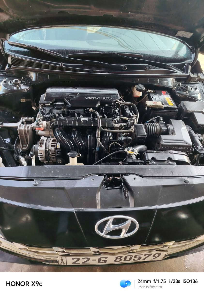 السلام عليكم النترا مديل 22
حادث موضح بالصور
رقم اربيل بأسمي
السعر 143
للتواصل واتساب ***********
