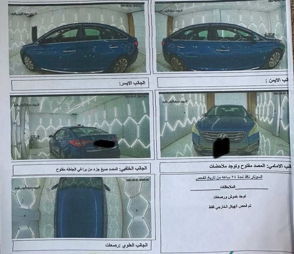 سلام عليكم
سوناتا ٢٠١٧ 

Sport 

موصفات معروفه 

السياره بدون صبغ 

جديده السياره وحلوه 

حادثه جنطه خلفيه فقط 

السعر 105قفل قفل متوازي على الفلوس 

رقمي /***********
