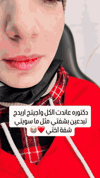 مرات سيسي واحد فلر يغير الشكل تماما لمن تحقنوا يم الناس الصح اللي ينطو...