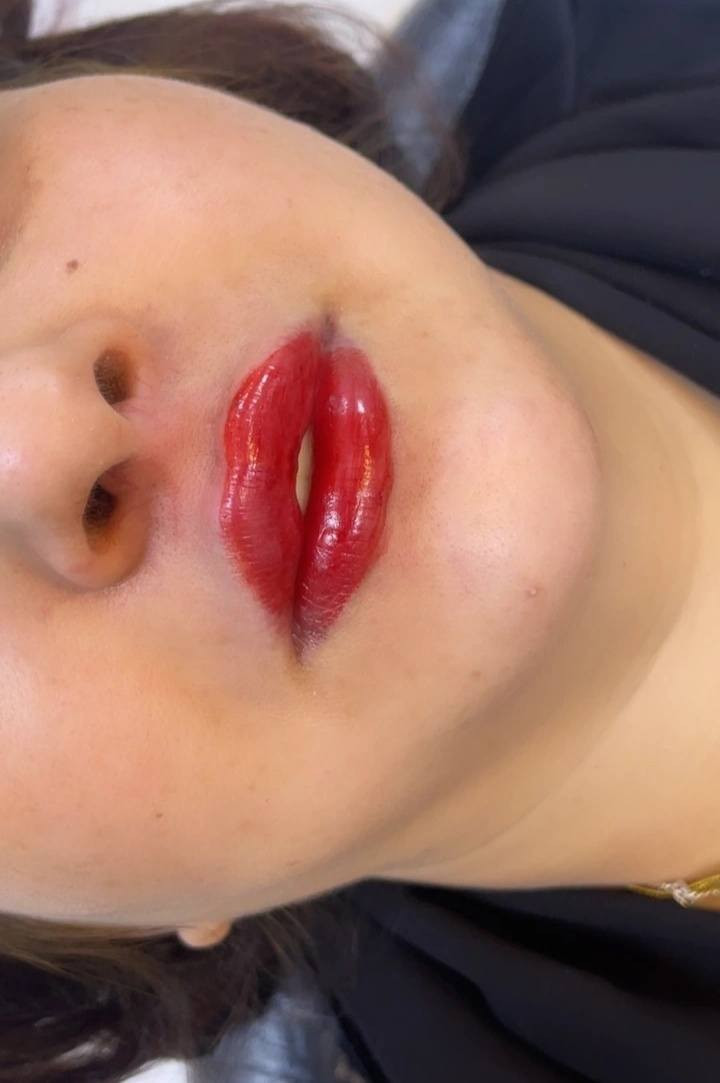 استقبلي العيد بهيج جمال شفة 
 قبل وبعد الحقن مستمرين بالعروض كيكاتي 🤭 
عروض كل هذا جمال 50


**إذا كنت صاحب هذا الإعلان وتريد حذفه لأي سبب، رجاءا أرسل رسالة إلى الدعم الفني**