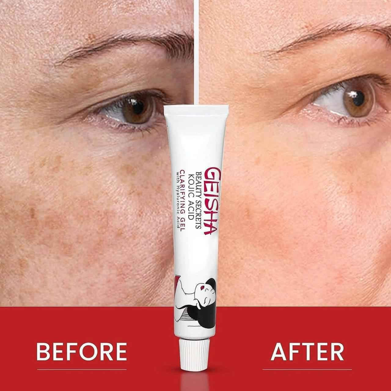 ✨ عصارة غيشا من كوجي ✨
GEISHA BEAUTY SECRETS KOJIC ACID BRIGHTENING 
CREAM

🌟 كريم غيشا العالمي 🌟
🔑 سر من أسرار الجمال بـ حمض الكوجيك 🔑
💖 فوائد المنتج:
 ⚡ أقوى كريم لتفتيح البشرة: يحتوي على حمض الكوجيك المعروف بقدرته العالية على تقليل التصبغات والبقع الداكنة.
 🎯 توحيد لون البشرة: يساعد في تحسين مظهر البشرة غير المتجانسة ومنحها مظهراً متناغماً.
 ☀️ مكافحة الكلف والنمش: يقلل من ظهور الكلف والنمش الناتج عن أشعة الشمس أو التغيرات الهرمونية.
 🌱 تفتيح آثار حب الشباب: يساهم بشكل فعال في تفتيح البقع الداكنة الناتجة عن الحبوب السابقة.
 💧 ترطيب خفيف: يحتوي عادةً على مكونات مرطبة بجانب حمض الكوجيك لتحسين نعومة البشرة ومرونتها.
المنشأ لبنان الأصلية 🇱🇧

السعر 25  مع التوصيل بغداد, العراق


**إذا كنت صاحب هذا الإعلان وتريد حذفه لأي سبب، رجاءا أرسل رسالة إلى الدعم الفني**