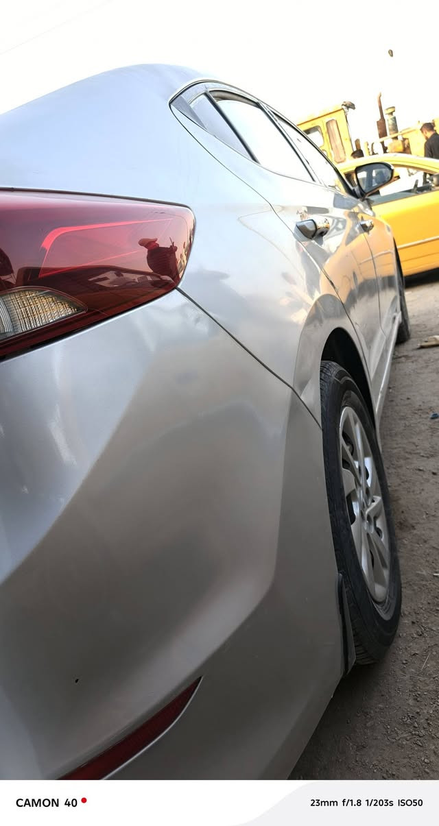 سلام عليكم
النترا خليجي م 2017 بيه قطعتين تبديل

وثنين صبغ مكينه كير كفاله ما مفتوح
السعر 118 

مكاني الديوانيه الحمزه الشرقي

***********
