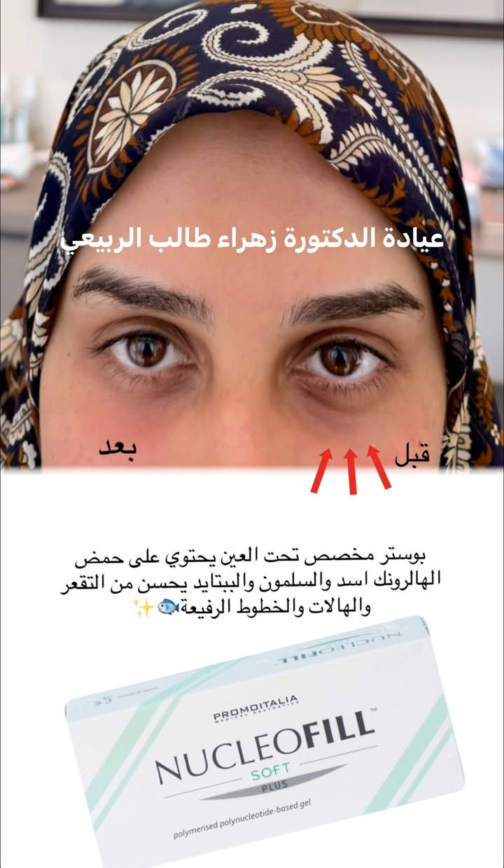 عروض شهر السابع بلشت من هسه حتى تحصلون على افضل نتيجة بموسم المناسبات💓💓💓⭐️‼️

العروض كلش تفيد العرايس ونصيحة اي عروسة تحب بشرتهه تلمع وبيها امتلاء وحيوية تشوف اخر ابرة نزلتهه الدكتورة على صفحتهه وياهه تنظيف بشرة مجاناً

لمعرفة اسعار العروض والحجز مراسلتنا واتساب ***********💓

المسيب / شارع البلدية
عيادة الدكتورة زهراء طالب الربيعي
قسم التجميل اللاجراحي💓
