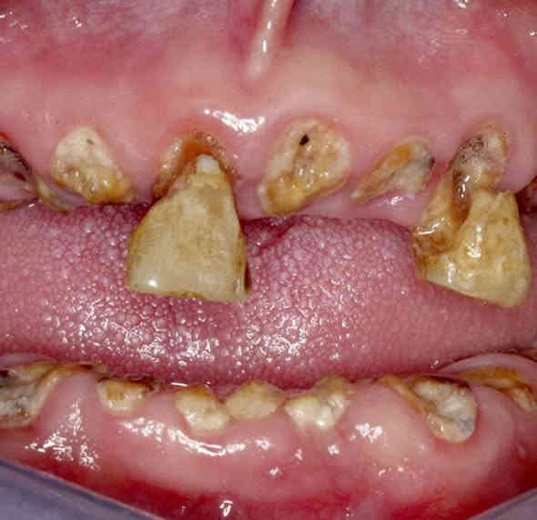 الي عنده هيج تسوسات او كسر بالسن محتاج قلع نكدر نعالجهم مجاناً في عيادات الجامعه الوطنيه 
(العمل مجاناً وباشراف اطباء اختصاص )
للاستفسار:***********
