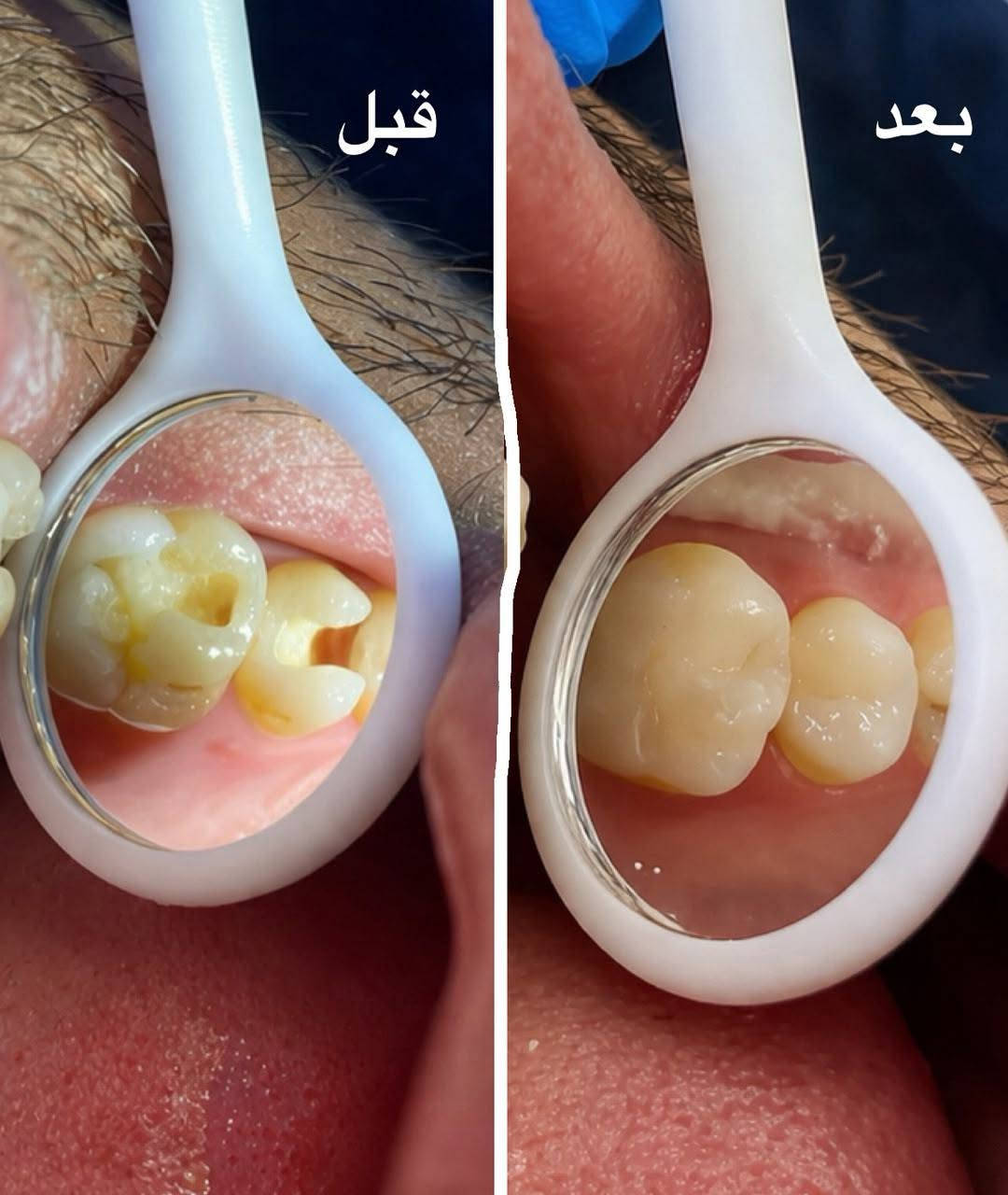 توجد طبيبة أسنان
العنوان : الحاج علي مقابل ثانوية الشهيد حسن الزيدان 
رقم الحجز : *********** 
أوقات الدوام طيلة ايام الأسبوع 
من 3 عصرا إلى 7 مساءاً
