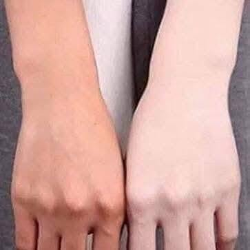 لكثرة الطلب وفرنا يجنن عن تجربه 
تخلي بعد متحتاجين مكياج ❤️ 
💕كريم  مبيض فوري سكن كير الأمريكي غني عن التعريف⁦♥️⁩

كريم سكن كير الامريكي 
‏Vitamin E skin care cream

كريم , للعناية بالبشرة

مبيض فوري  ضد الماء يستعمل للوجه والجسم والمناطق الحساسه يعني تفليششششش  ويعطي بياض نقي وصافي يستخدم بديل عن الاساس والباودر ويرطب الجسم وفيه فيتامين E 
يعمل كريم فيتامين. E على ترطيب البشرة تنعيمها وحمايتها من العوامل البيئية الضارة لبشرة اكثر نضارة ومظهر اكثر شبابا
كما يعمل على خفاء الخطوط البيضاء التي تحدث بجسم او في منطقه البطن 
ويخفي الاسود تحت العين 

ب٥ الاف فقط الاصلي الاصلي 
يوجد خدمة توصيل داخل بلد


**إذا كنت صاحب هذا الإعلان وتريد حذفه لأي سبب، رجاءا أرسل رسالة إلى الدعم الفني**