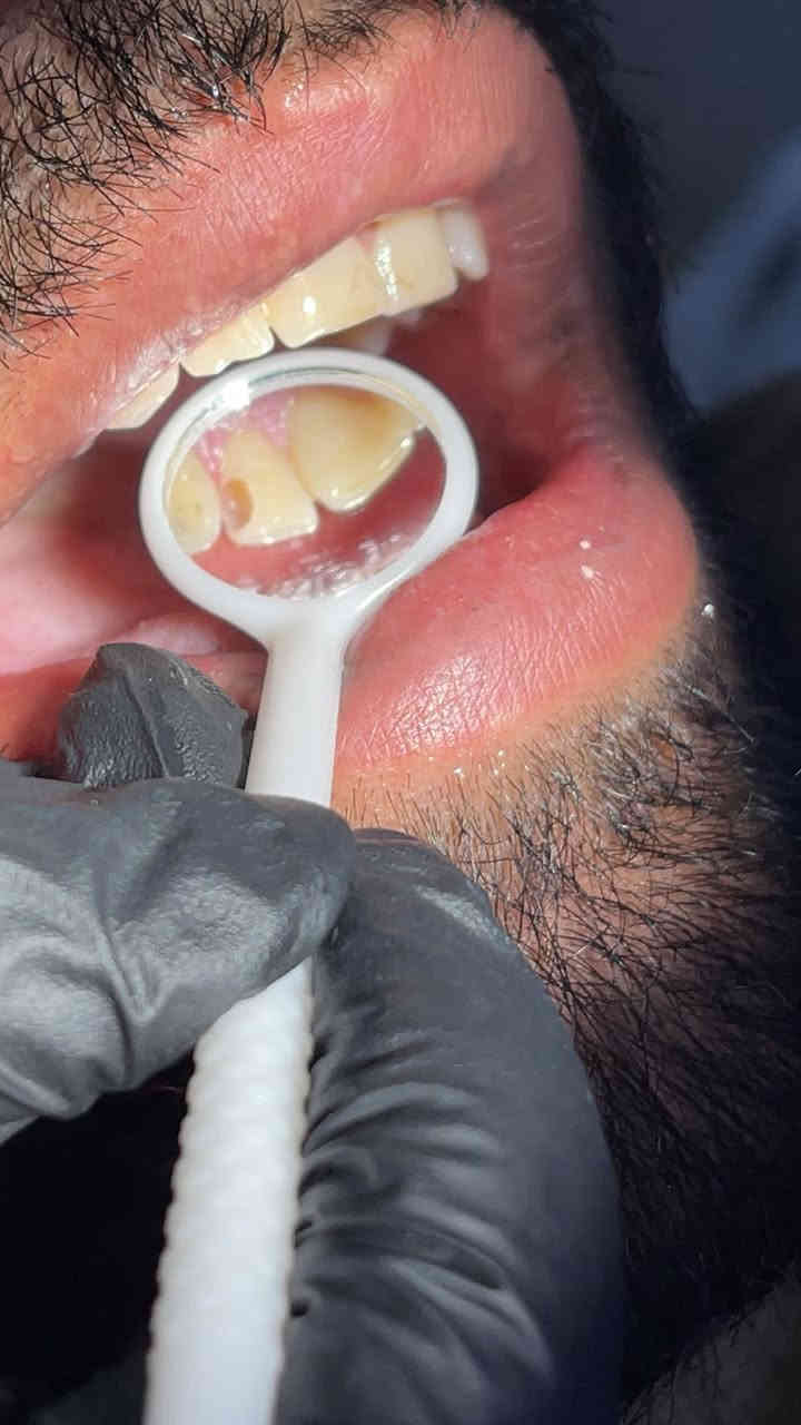 مستمرين بعروضنا داخل العيادة للحجز و الاستفسار ***********
