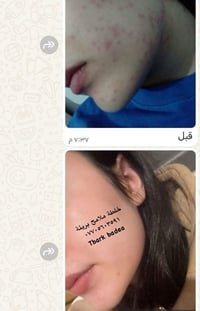خلطة ملامح بريئة • مفعول مثبت • نتائج مبهرة