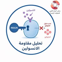 تحليل HOMO-IR • صيام ٨–١٢س • بابل الحصوة