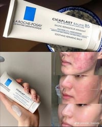 سيكا بلاست • لاروش بوزيه • ما بعد الليزر