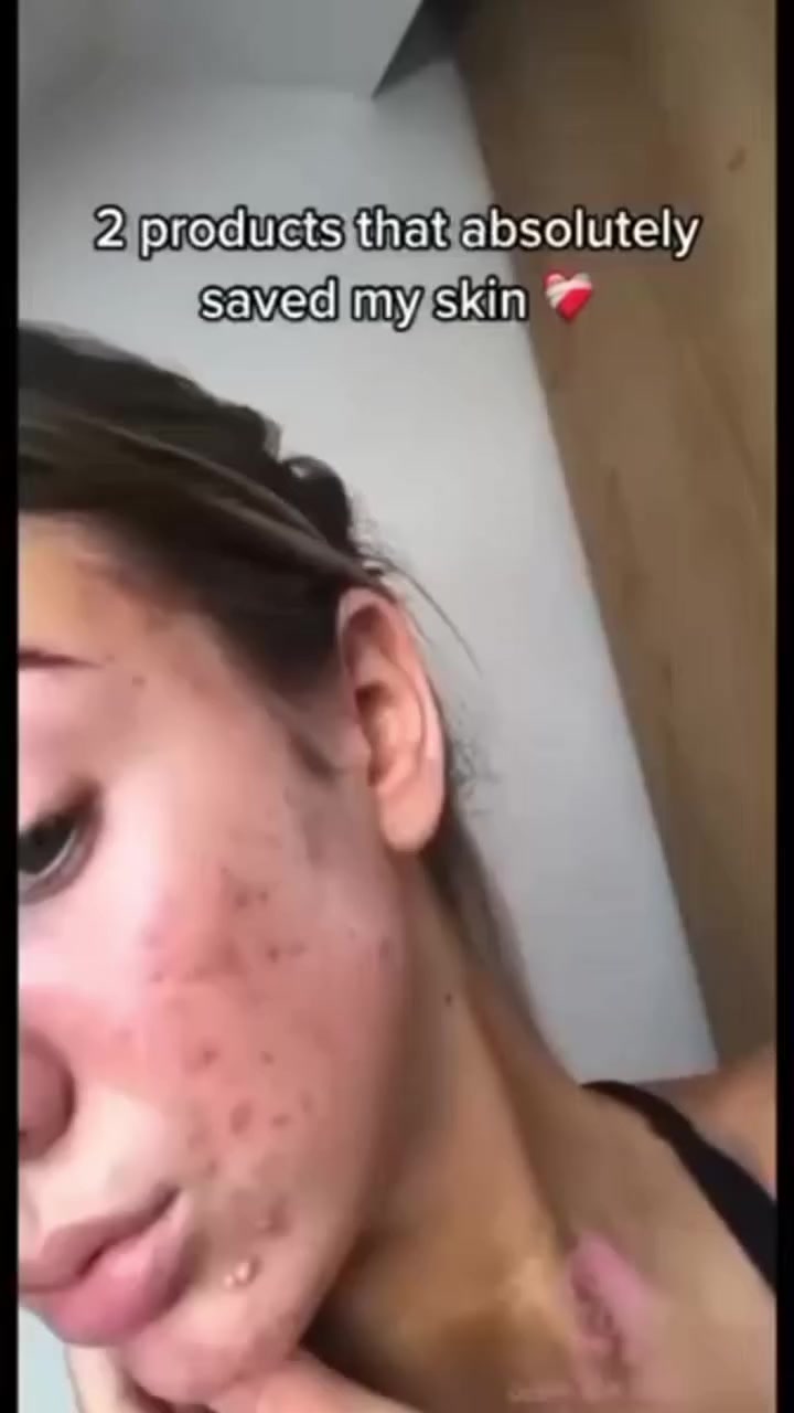 🎀عرض خاص توصيل مجاني لمدة يومين فقط🎀

♥️عرض من لاروش بوزيه الفرنسية 🇫🇷 للبشرة الدهنية والمختلطة♥️

1. كريم لاروش بوزيه لعلاج حب الشباب و مشاكل البشرة 
الدهنية  والمختلطة. 

‎❇️يستخدم أيضاً للحبوب السوداء ويمنع انسداد المسامات وتوحيد لون  البشره
‎❇️يعمل كمضاد للبكتيريا ويقلل ظهور الحب من جديد .
‎❇️يتحكم في الافرازات الدهنية ويساعد على منع  انسداد المسام .
‎❇️كما يجدد خلايا البشرة ويقلل من ظهور الرؤوس السوداء المزعجه . 
‎❇️يتخلص من لمعان البشرة الدهنية .
‎❇️يقاوم البقع الناتجة عن حب الشباب ويخفيها .
‎❇️مصحح للعيوب مدعم بحمض السالساليك .
‎❇️سريع الامتصاص ولايترك

2. 💙اخترتلكم هذا الغسول اللطيف من #لاروش الفرنسية💙 
💙غسول لاروش للبشره الدهنيه والمختلطه من أكثر 
💙جميل جدآجدآ في تنظيف البشرة والدهون بشكل عميق 
💙وملمسه علي البشره حلووو غير هكي هو مضاد للميكروبات 
💙يساعد في الحد من ظهور الحبوب الناتجه عن تراكم البكتيريا 
💙مميزات إيفاكلار للبشرة الدهنية
يتميز إيفاكلار بـ: 
💙تقليل الرؤوس السوداء بنسبة 25%. 
💙تقليل إفراز الدهون بنسبة 16%. 
💙حموضة مناسبة للبشرة 5.5PH.
💙طبي وامن للبشرة تماما 100 ‰
منشأ العرض فرنسي 🇫🇷


**إذا كنت صاحب هذا الإعلان وتريد حذفه لأي سبب، رجاءا أرسل رسالة إلى الدعم الفني**