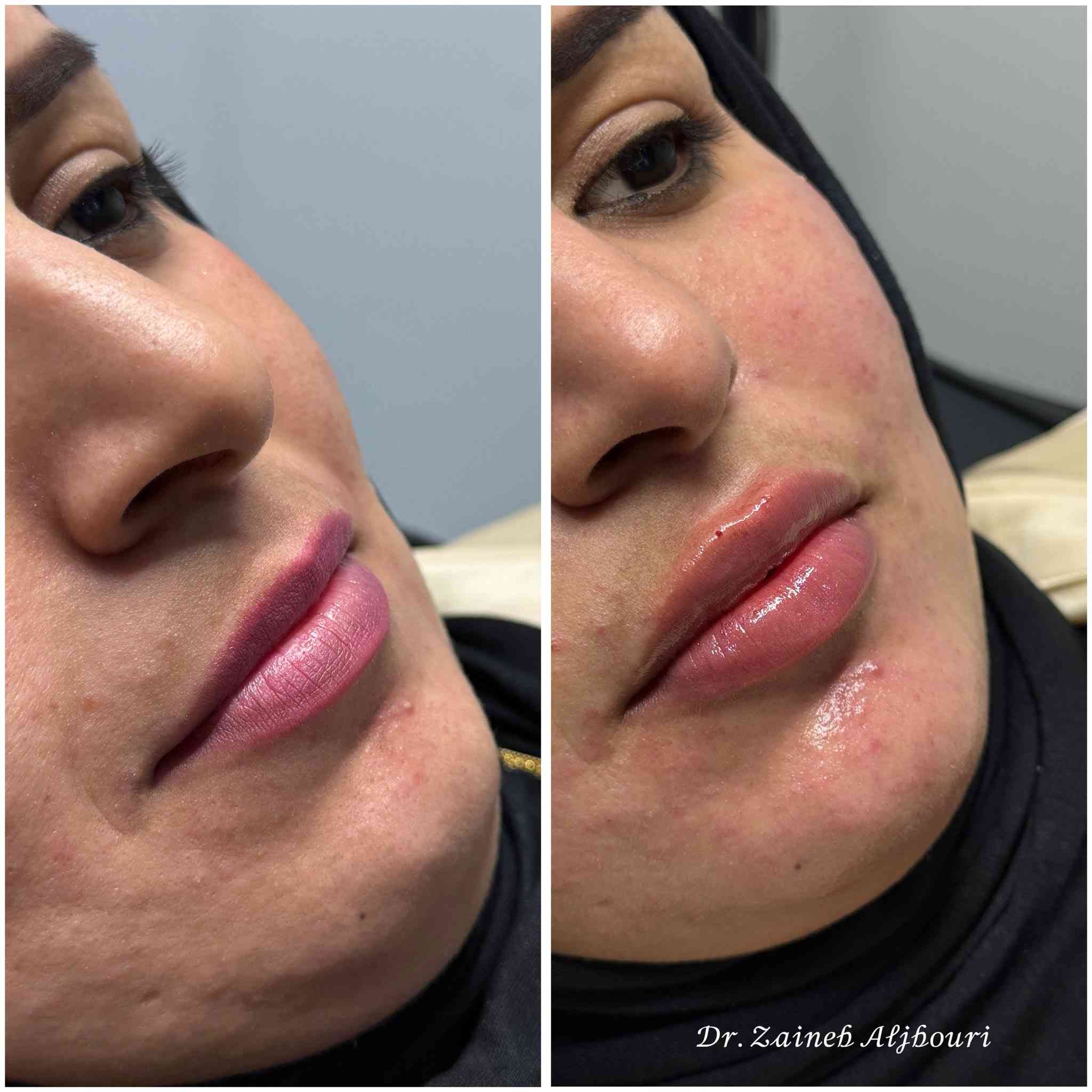 هلو بنات عندي عروض تجنن للعيد تابعوني انستا dr_zaineb_m والتواصل ع الرقم *********** 💗
