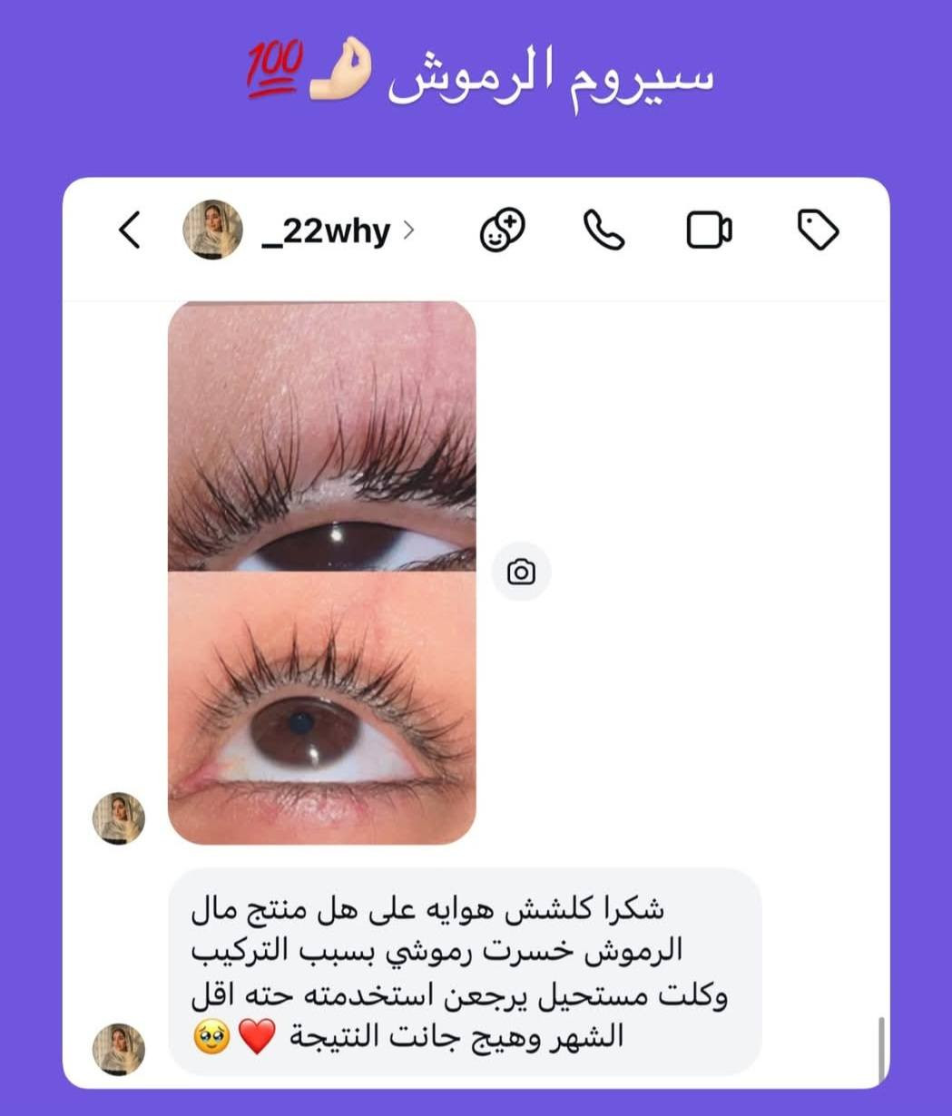 مليتي من فراغات حاجبج🤔
حاجبج خفيف وتريدين تثخني 🧐

زين رموشج شلونها تريدين تكثفيها وطوليها 🤨

😎الحل عندي  

⭐️تركيبه زيتيه لتكثيف الرموش والحواجب⭐️

🤓استعماله سهل جدا🤓

قبل متنامين حطي على رموشج وحواجبج ونامي والصبح غسلي

وحتى متنسي حطي الزيت يم فراشج 😁 انسي جلسات ولرموش وغير فقط ستعملي سيروم زيوت طبيعيه لحاجب ولرمش يكثف يطول شعر لحاجب ولرمش  وينبت. شعر خلال خمسه تيام


**إذا كنت صاحب هذا الإعلان وتريد حذفه لأي سبب، رجاءا أرسل رسالة إلى الدعم الفني**