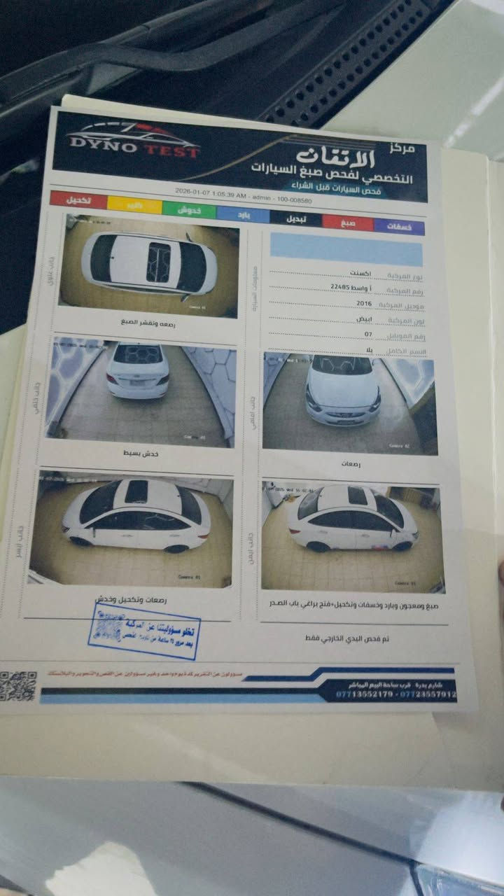 سلام عليكم ورحمة الله وبركاته اكسن مديل ٢٠١٥ واسط تحويل مباشر سنويةلغاية ٢٠٢٦ السونار  مرفق مع الصور السيارة بلكوت كفالة عامة وضع الشركة ماشية ٢٥٠ الف محرك حدادية تبريد تخم داير محرك ١٦٠٠ وضع الشركة مال بيت السيارة بسم اخوي السعر ١١٣ اخوان متواجد على الفيس بوك مااجاوب على الفيس بوك رقم الموبايل ***********
