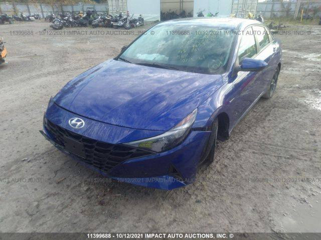 السلام عليكم الانتر امريكي مديل 202‪1 بسمي رقم جديد بصمه فتحه رادار تحديد مسار فول مواصفات المكان الشعب قرب السواق المركزيه السعر 147‪ وبيها مجال حك الجيه بيع او مراوس ماشيه 68 ميل
***********‪
