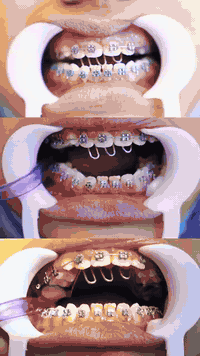 دكتورة ميس الريم • تقويم اسنان • العزيزية واسط