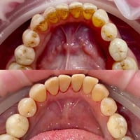 كل خدمات الأسنان 💕 كل خدمات الأسنان 💕 ✔ تنظيف وتلميع الأسنان ✔ حشوات ت...