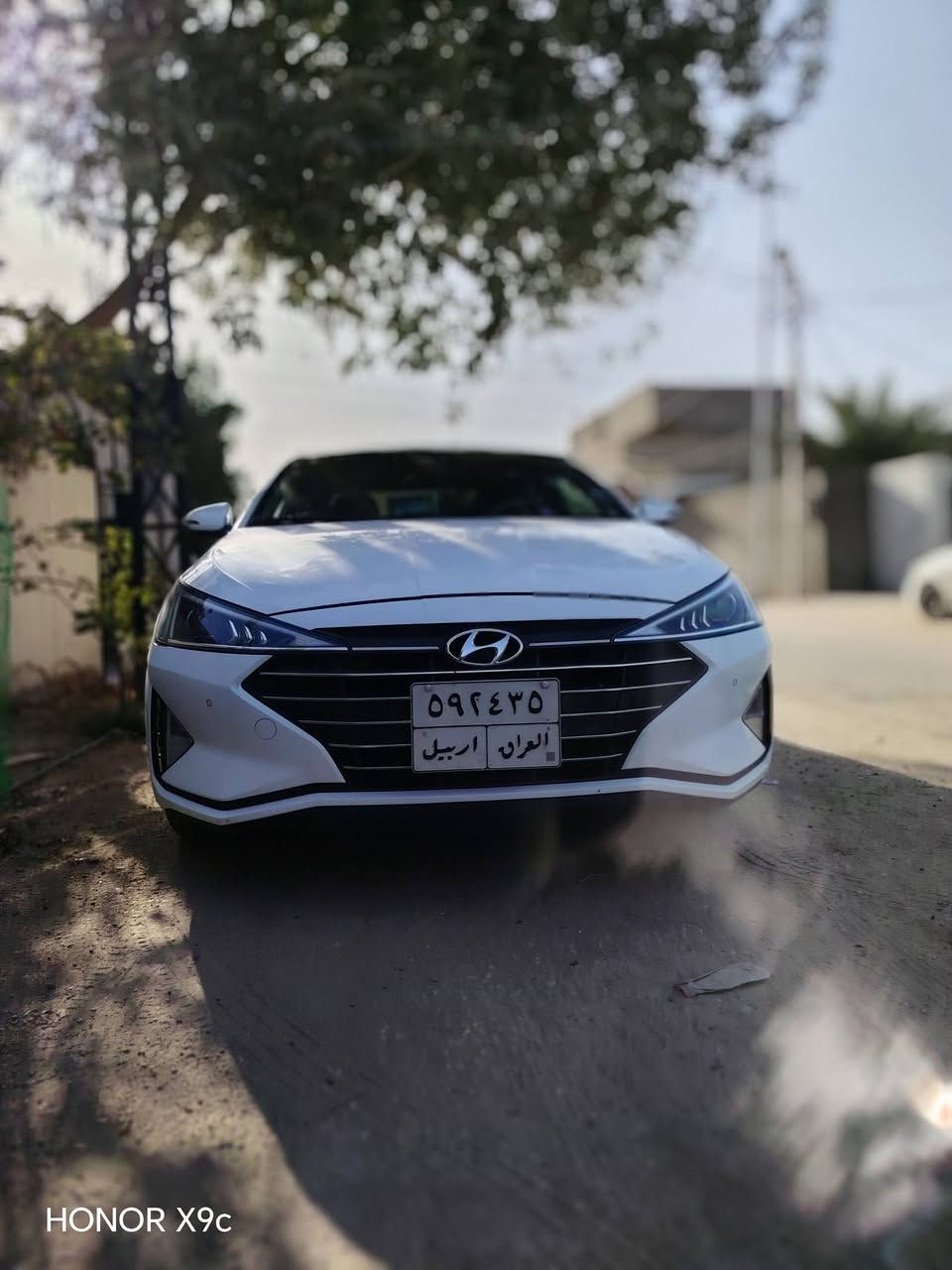 الانترا
موديل 20
خليجي كفاله عامه
رقم أربيل وكاله
مكينه 2000
فول مواصفات 1/1
مكينه وكير شرط
ممشه 170 كيلو متر
سياره جديده بمعنئ الكلمه
وبل عافيه عل ياخذها
***********
