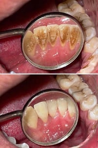 تنظيف أسنان • مجاناً • كربلاء