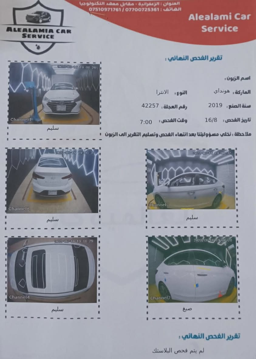 السلام عليكم النترا خليجي 2019 كامل موصفات تنتا سقفية بصمة
تدافئه تبريد جديد الون ابيض ماشية 155 كيلوا 
رقم موبيل *********** وبية وتساب

السعر 135 $وبية مجال بسيط
