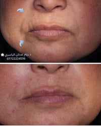 عيادة الضياء سمايل • تجميل أسنان • السماوه حي المعلمين