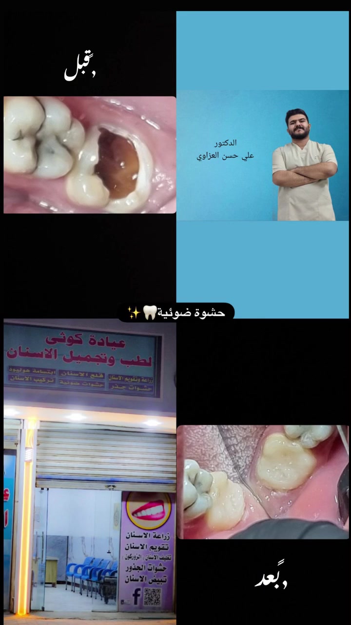 #عيادة_كوثى_لطب_وتجميل_الاسنان
#الدكتور_علي_حسن_العزاوي 
جبله/نهاية شارع الاطباء
مقابيل الدكتوره ميثاق المعموري

***********//للاستفسار
