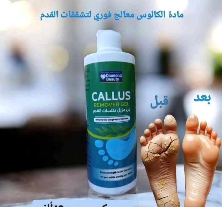 متوفر مادة الكالوس لازالة تشققات وخشونة القدم 
الكميه محدوده والتوصيل داخل العراق فقط‼️

مادة الكالوس أو مزيل التشققات تحتوي عادة على مواد فعّالة تذوّب الطبقة السميكة من الجلد الميت.
أهم المواد الفعّالة هي :

⸻

المواد الفعّالة الرئيسية:
 1. Urea (اليوريا):
 •تطرّي الجلد القاسي وتساعد بتقشيره بلُطف.
 •تشتغل كمرطب وكيميائي يلين الخلايا الميتة حتى تنشال بسهولة.


**إذا كنت صاحب هذا الإعلان وتريد حذفه لأي سبب، رجاءا أرسل رسالة إلى الدعم الفني**