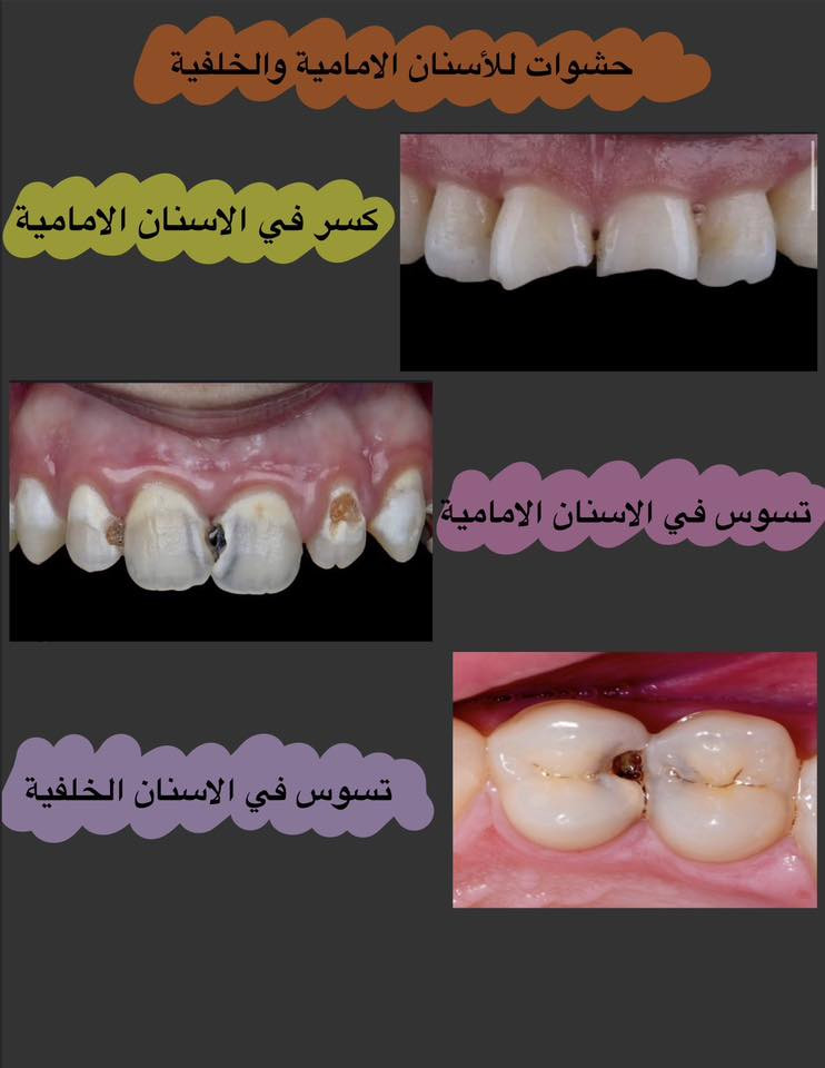 📍عيادات ابن سينا التخصصية-مقابل محطة وقود البياع
📝للحجز والاستفسار:
.مراسلة الصفحة
.واتساب ***********
✨علماً ان العلاج مجاني بالكامل
