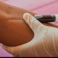 🔬 خدمة سحب الدم المنزلي – راحة وأمان 🏠 نوفر خدمة سحب عينات الدم من الم...