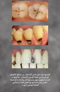 وبركاته ، ان شاء الله العيادات ( المجانية ) لـ حشوات الاسنان وعيادات ا...