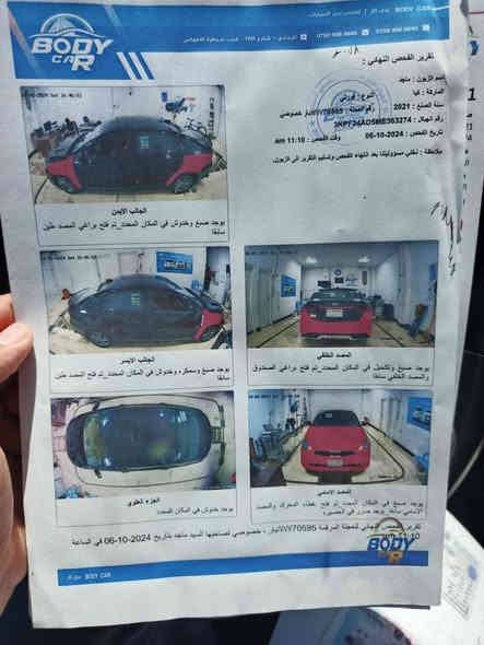 🚘✨ للبيع – كيا فورتي 2021  (معوقين) ✨🚘

📌 المواصفات العامة:

الموديل: 2021

النوع: كيا فورتي (سيدان)

اللون: أسود لامع

رقم انبار خصوصي

📍 المحرك والأداء:

محرك 2000 4 سلندر ، اقتصادي بالبنزين

ناقل حركة أوتوماتيك (جير ناعم وسلس)

نظام توفير الوقود (Eco Mode)

📍 الداخلية والراحة:

مقاعد مريحة مع تحكم كهربائي للسائق

شاشة وسطية مع بلوتوث وكاميرا رجوع

نظام صوتي ممتاز

تحكم بالمقود (مالتي ستيرنغ)

تكيف بارد وسريع

📍 الأمان والتقنيات:

 كاميرا رجوع

وسائد هوائية (Airbags) أمامية وجانبية

نظام مانع انزلاق ABS

مثبت سرعة (Cruise Control)

📍 الخارجية والشكل:

إنارة LED أمامية وخلفية

لون أسود أنيق 

✅ السيارة نظيفة مثل ما واضح بالصور
✅ استخدام مرتب وماكو بيها مشاكل

💰 السعر: 125 وبيها مجال)
📞 للاستفسار والاتصال: (***********)
