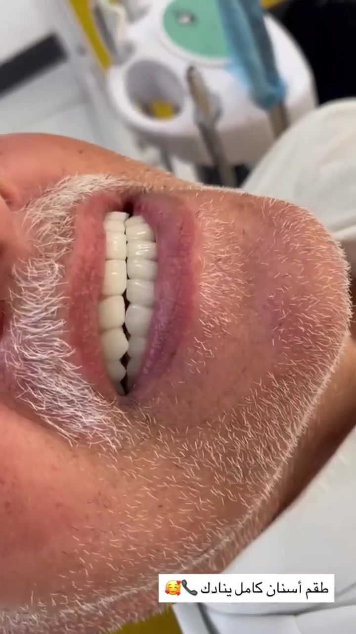 ✨ ابتسامتك... عنوان ثقتك ✨

لا شيء يترك أثرًا أجمل من ابتسامة صحية ومشرقة.

في مركز سما المناذرة لطب الأسنان، نساعدك لتحافظ على جمال ابتسامتك وصحة أسنانك من خلال أحدث الخدمات والعناية المتخصصة.

🦷 لأن ابتسامتك تستحق الأفضل
🦷 ولأن الثقة تبدأ بابتسامة جميلة

📍 مركز سما المناذرة لطب الأسنان
ابتسم بثقة... نحن نهتم بالتفاصيل.
العنوان / النجف الاشرف _ المناذرة _ الشارع العام _ قرب مستشفى
 المناذرة _عمارة الحاج ابو نبيل جانب صيدلية الأصالة
 للحجز والأستفسار / ***********
الساعه 9:00 صباحا الساعه 1:00 ظهرا من الساعه 3:00 ظهرا الى الساعه 9:00 ليلا ًَ
