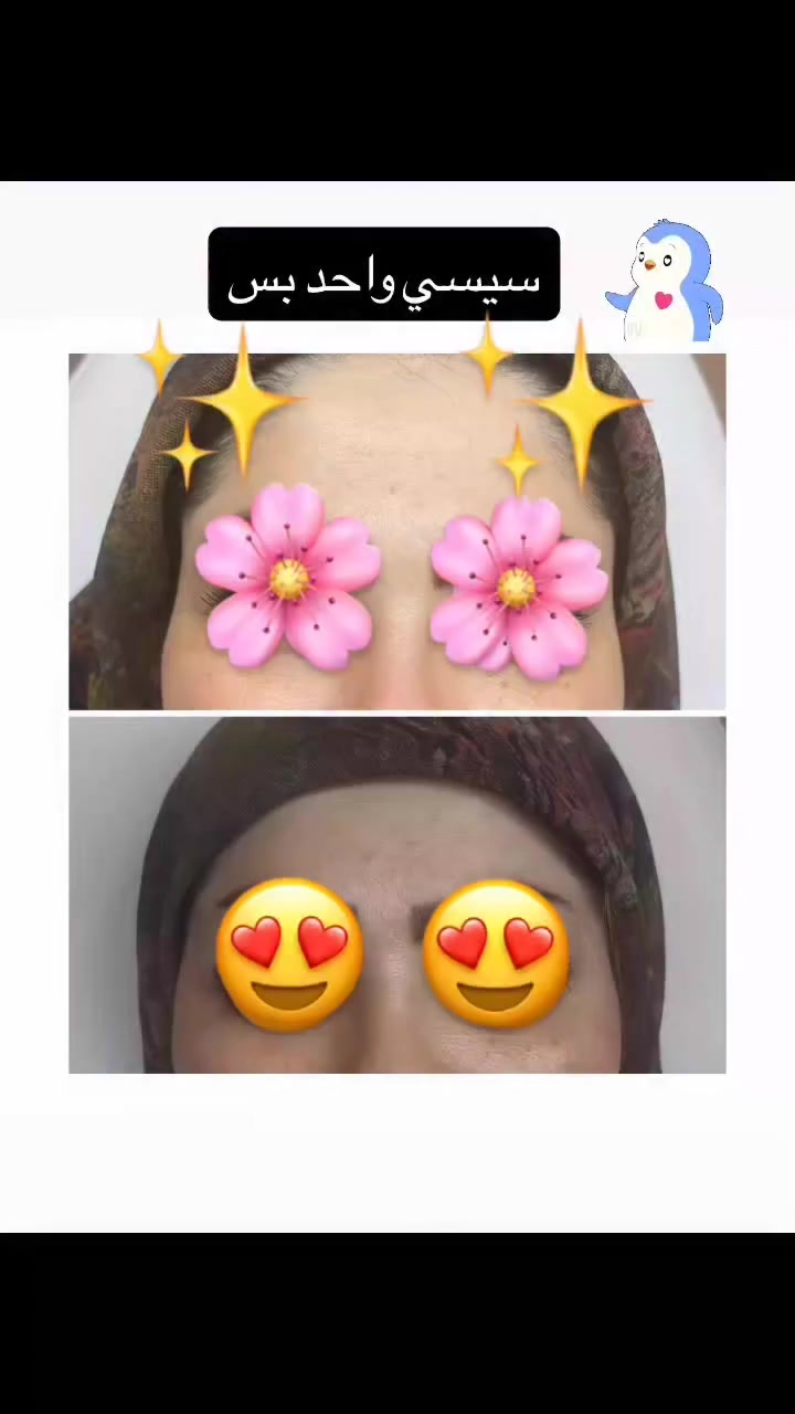 نبأ الشمري ✨ لأن صحتك وجمالك يستاهلون الأفضل ✨
تقدم لكم عيادة [الضياء سمايل]
أفضل الخدمات الطبية والتجميلية بأحدث الأجهزة وعلى أيدي مختصين 💉🌸
✔️ استشارات طبية دقيقة
✔️ جلسات تجميل وعناية بالأسنان
✔️ نتائج مضمونة واهتمام بأدق التفاصيل
📍 الموقع: [السماوه حي المعلمين مقابل نيكست لفل]
📞 للحجز والاستفسار: [***********]
💖 راحتك وثقتك بين إيدينا 💖

https://www.instagram.com/dr.riyam_alyasiri?igsh=N2xva2FtOHNpNXpi
