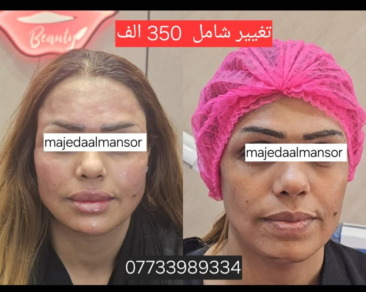 التغيير الشامل يمنه وبس  👄💅

هدية ابرة كريستال مع كل تغيير شامل 
عروض  الدكتورة ماجدة المنصور Jojo Alnabeel 
العنوان بغداد الحسينية مقابل السوق الكبير مجاور مرطبات العذراء
مجمع سما الحسينيه للطابق الثاني قسم التجميل والصالون ***********
