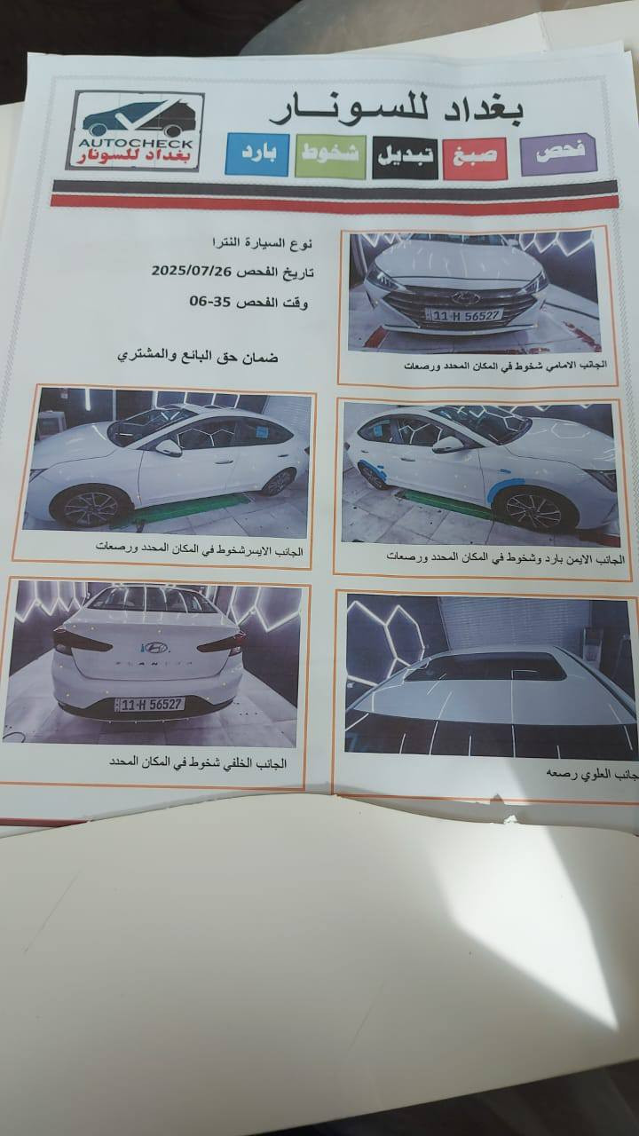 بيع_سريع

السلام عليكم....

للبيع هونداي النترا خليجي 2020مكفوله من الضربة والصبغ والحادث السيارة جديدة فول مواصفات فتحه سقف وبصمه دخول وتشغيل وصندوك ذكي وباقي المواصفات المعروفة ماشية 86الف سبير منازل رقم بغداد تحويل مباشر السياره جاهزة تبريد ثلج كير محرك كفالة والسونار مرفق مع الصور 
العنوان بغداد ابوغريب 

رقم الهاتف ***********

لبيع سيارتك راسلنا 📩 خاص عبر سوق بغداد أون لاين 
لمعرفه السعر سوي تعليق على المنشور الاصلي داخل سوق بغداد أون لاين ـــــــ Baghdad Market Online
