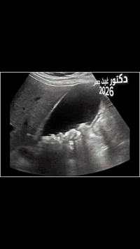 دكتور غيث جعفر
بورد الدكتوراة 
أشعة وسونار والدوبلر الملون 
العنوان جبلة شارع الاطباء 
مجمع صدف الطبي 
*********** 
***********
