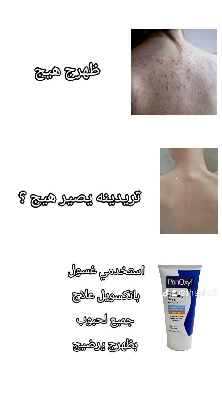 هلو بنات 🩷⋆𐙚⋆🦢عرض لمدة محدودة سيتم اختيار حسابج للفوز بـعرض VIP الخاص بلمتجر🥹✨
غسول PanOxyl حسب بشرتج + سيرومات The Ordinary الثلاثية + هدية 🎁 من اختيارج بسعر 26 توصيل مجاني 💸 بدل 45 ❌ يخلصج من الحبوب وآثارها، يقلل المسام والهالات، ويعطي لمعة ونضارة من أول أسبوع 🫧 لمدة يوم فقط ! تحبين أثبتلج الأوردر؟ 🫰🏻💗


**إذا كنت صاحب هذا الإعلان وتريد حذفه لأي سبب، رجاءا أرسل رسالة إلى الدعم الفني**