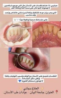 تتوفر علاجات مجانية في عيادات جامعة البيان 🤎  وتكون للحالات التالية:  ...