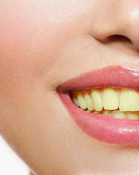 مو كل ابتسامة تنحل بفِلتر… مرات تحتاج حل صح من الجذور ✨
إذا ضايجك اصفرار الأسنان ومخلي ثقتك أقل، هذا الثنائي راح يفرق ويهك من أول استعمال:
🦷 Pasta Del Capitano
معجون إيطالي ينظف بعمق ويشيل تصبغات الجاي، القهوة والتدخين بدون ما يضر الأسنان.
💜 قطرات Eelhoe البنفسجية
لمسة بنفسجية ذكية تعادل الاصفرار فوراً وتخلي لون أسنانك أفتح وأنصع بسرعة.
شنو النتيجة؟
ابتسامة تلمع… نفس منعش… وثقة تبين عليك 😎✨
✔ فرق ملحوظ من أول مرة
✔ يشيل التصبغات السطحية
✔ إحساس نظافة يدوم

👈🏻💌اي استفسار او الحجز👇🏻
 
***********
#لجميع 
#توصيل_جميع_المحافظات_العراق بغداد, العراق
