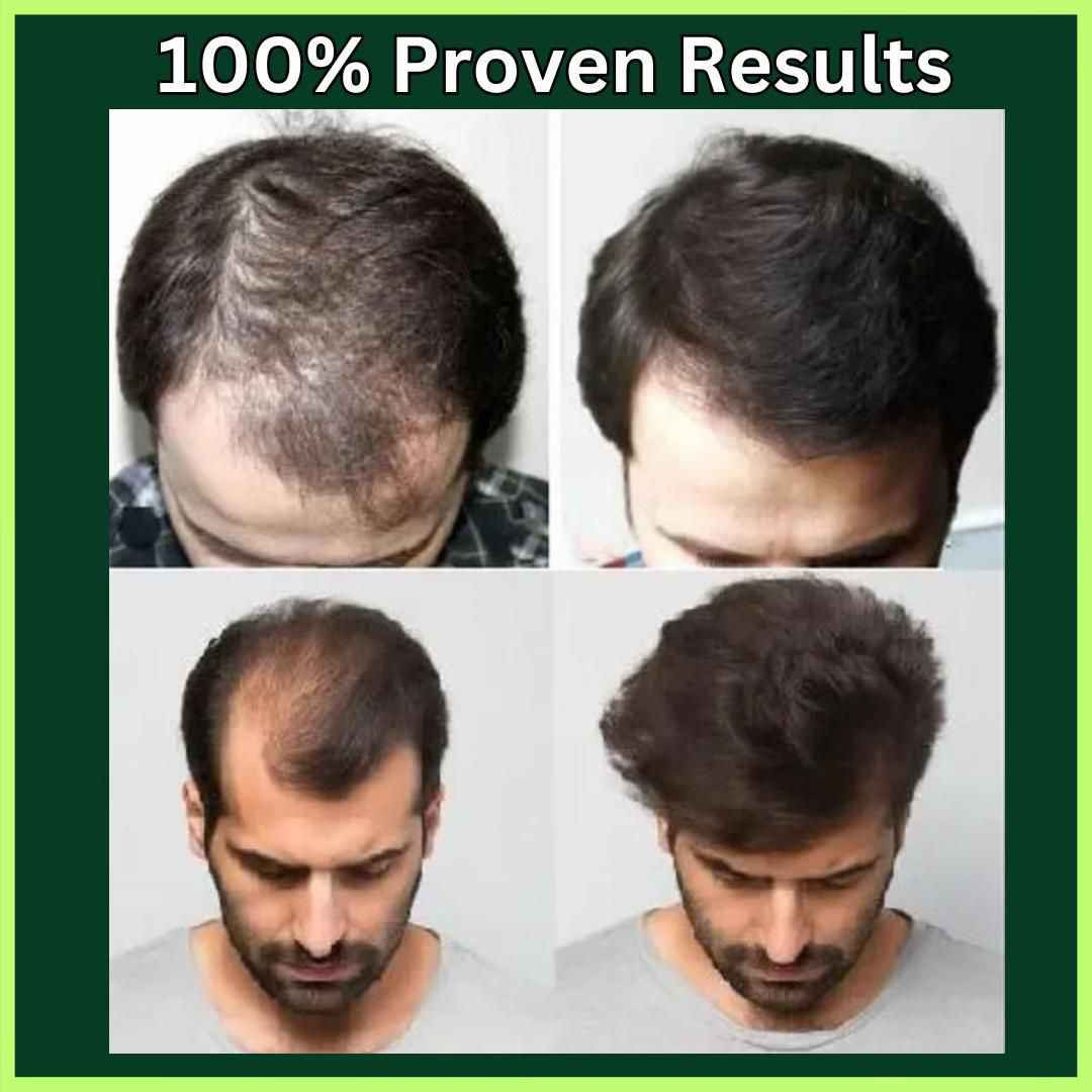 108 عشبة هندية.. يعني الحل الجذري لكل مشاكل الشعر! 🇮🇳✨
ليش زيت Adivasi مختلف عن أي زيت ثاني بالسوق؟
لأن تركيبته فريدة وتتكون من 108 عشبة طبيعية صافية! 🍃
يعني دتنطين شعرج فيتامينات ومعادن وعلاجات مكثفة بلمسة وحدة.
✅ يعالج الصلع الوراثي والتساقط الكربي.
✅ يثخن الشعرة ويمنع تكسرها.
✅ يطول الشعر بفترة قياسية.
✅ يرجع الحيوية للشعر التالف والمحروق.
دللي شعرج بخلاصة الطبيعة.. 💆‍♀️

صنع في الهند النجف, العراق


**إذا كنت صاحب هذا الإعلان وتريد حذفه لأي سبب، رجاءا أرسل رسالة إلى الدعم الفني**