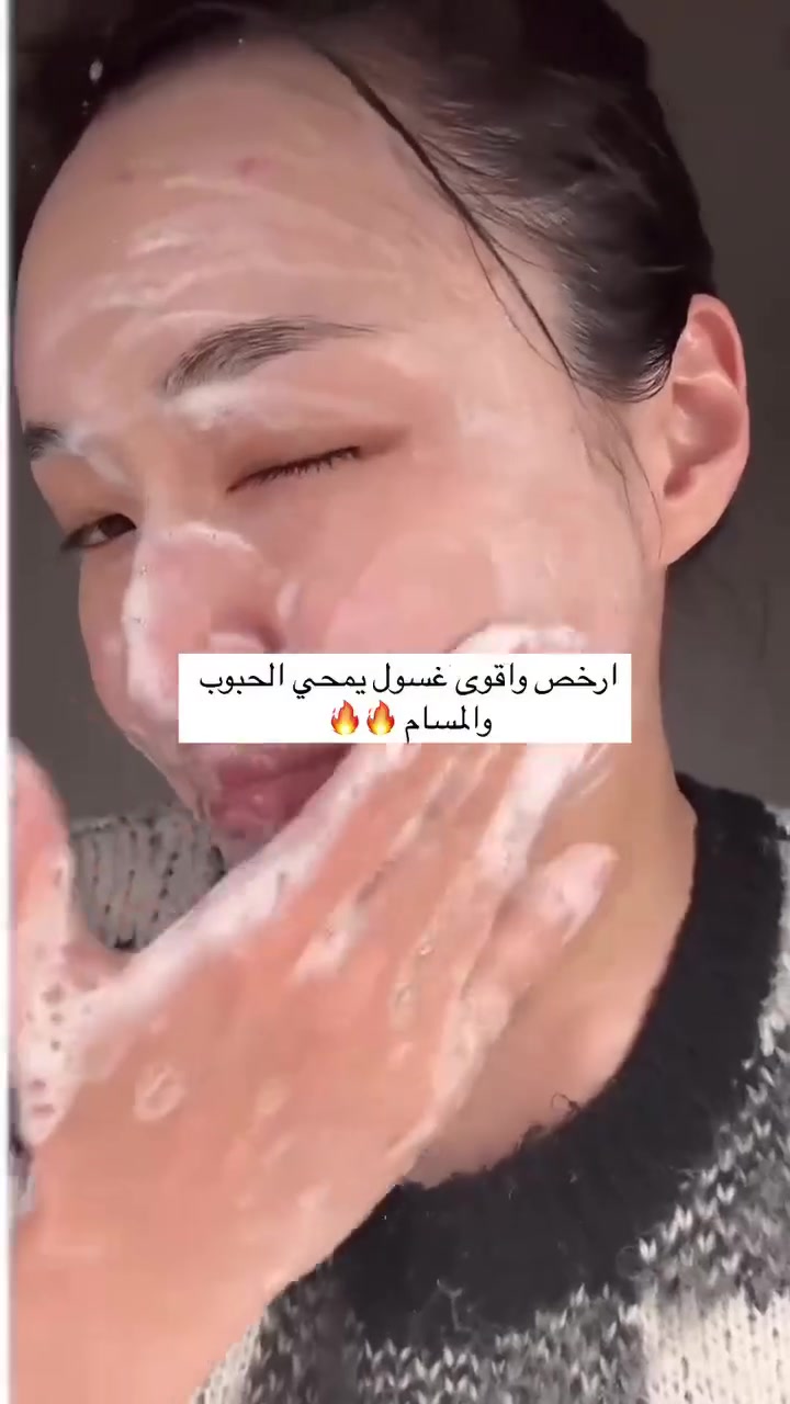 ✨غسول الوجه سنتيلا  الرغوي بنبتة السنتيلا 
✅SKIN1004 Madagascar Centella Ampoule Foam. 🇰🇷💯
✨يحتوي الغسول على مستخلص كينتيللا أسياتيكا من مدغشقر، المعروف بخصائصه المهدئة والمضادة للالتهابات. يتميز بتركيبة ذات درجة حموضة منخفضة (pH 5) تناسب توازن البشرة الطبيعي، ويزيل المكياج والشوائب بفعالية دون تجفيف البشرة. 
مناسب لجميع أنواع البشرة، بما في ذلك البشرة الحساسة. يساعد في تهدئة البشرة المتهيجة وتقليل الاحمرار، كما يوفر ترطيبًا عميقًا بفضل المكونات مثل حمض الهيالورونيك والجلسرين. يحتوي على مسحوق بيكربونات الصوديوم فائق النعومة الذي يساعد على امتصاص الشوائب وإزالتها من المسام

✅الفوائد:-
1.ترطيب وتهدئة فوري
• يقلل الاحمرار والشعور بالحساسية خاصةللبشرة الحساسة أو الملتهبة.
2. توازن الحاجز الجلدي
• يقوّي الطبقة الخارجية من الجلد، فيقلّ الفاقد اليومي للرطوبة.
3. تنظيف بقايا المكياج والأوساخ
• رغوته اللطيفة تزيل الزيوت الزائدة والشوائب من المسام دون جفاف.
4.مناسب للبشرة المعرضة لحبّ الشباب• خواص السنتيلا المضادّة للبكتيريا والالتهاب تساعد في تهدئة البثور وتقليلها..
#الاصلي المنشأ كوريا 🇰🇷💯


**إذا كنت صاحب هذا الإعلان وتريد حذفه لأي سبب، رجاءا أرسل رسالة إلى الدعم الفني**