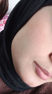 صابونة كولاجين • بدون مكياج • خلال اسبوعين