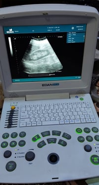 (( جهاز سونار للبيع )) - جهاز سونار نوع Edan Dus60 مستعمل وبسعر مناسب ...