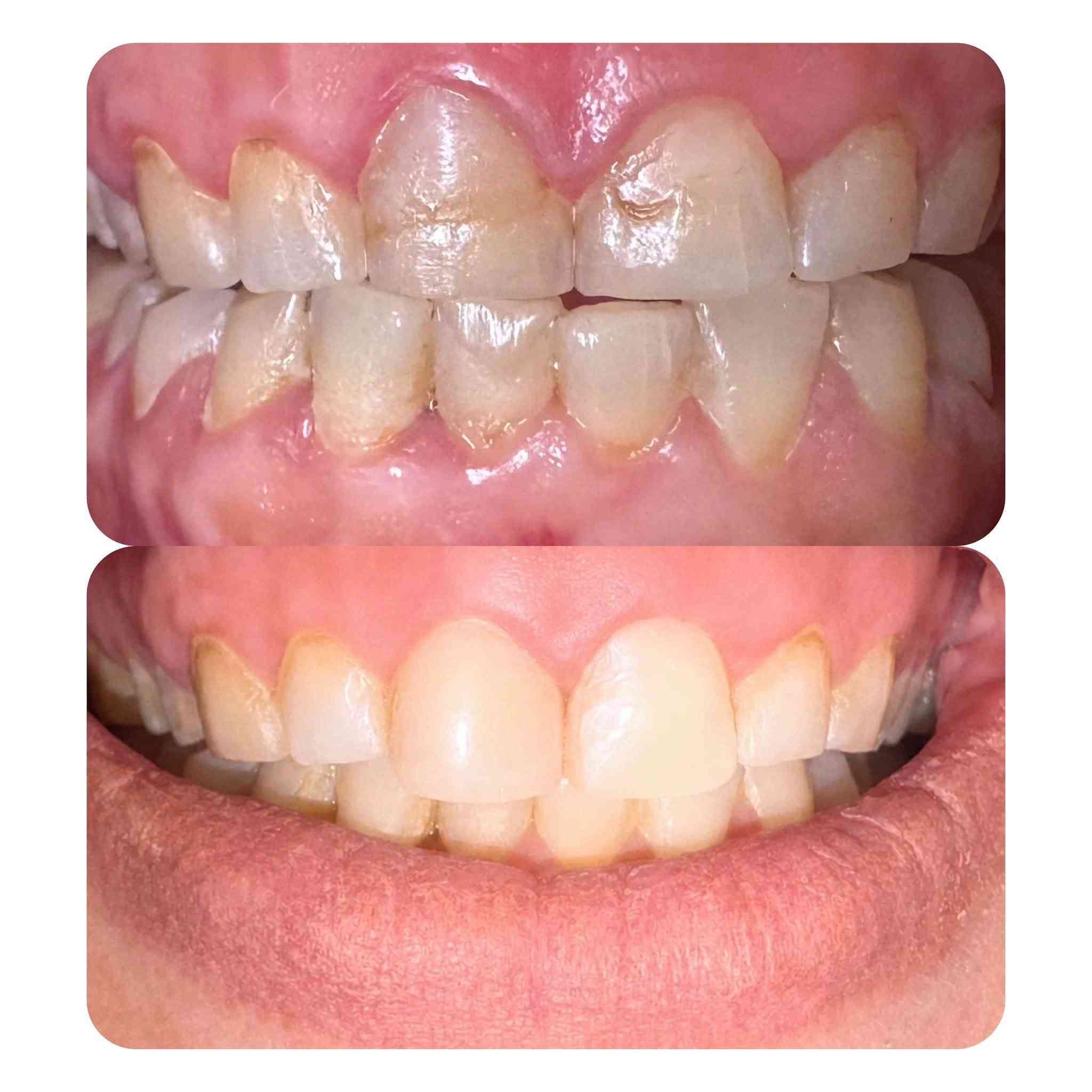 مرحبا بنوتات  شلونكم
وياكم د.شهدسعدي اخصائيه تقويم و سرتفكيت تجميل اسنان متواجدة بعيادة عياده الرحيق لطب وتجميل الاسنان قرب سوق علي نعمة السبت الاثنين الاربعاء صارلنا خمس سنوات والحمدلله مراجعينا يعرفون شون شغلنا نظيف و علمي و ننصح بالشي الزين و اسعارنا مناسبه 
رح اخليلكم صور من شغلي و اي استفسار عدكم تكدرون تتواصلون ويانه على الرقم *********** 
وهذا حسابي على الانستا 
https://www.instagram.com/drshahadsaadi618?igsh=Mjhkemhnbzdld3R5&utm_source=qr

